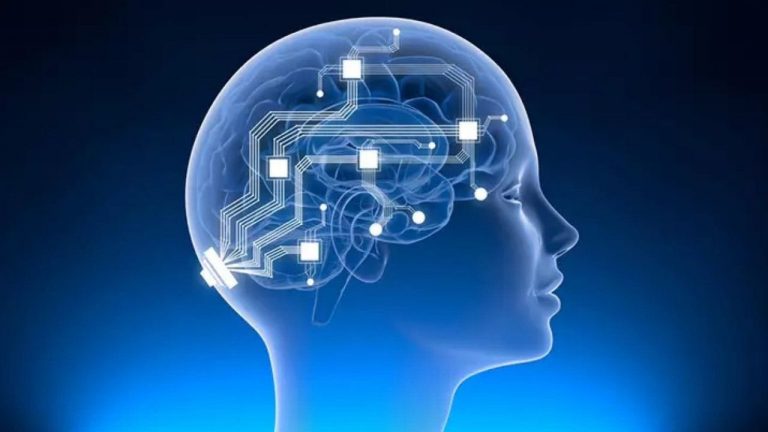 Neuralink will start human brain implant trials