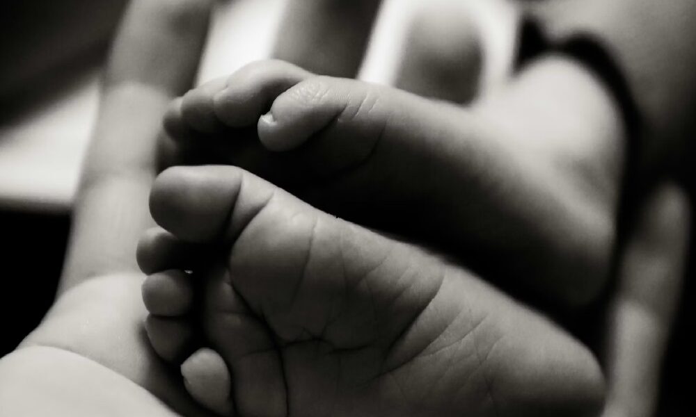 Limpopo conjoined twins birth, Mankweng Tertiary Hospital neonatal unit, conjoined twins South Africa, Limpopo Department of Health hospital care, neonatal intensive care Limpopo, medical team caring for conjoined twins, Joburg ETC