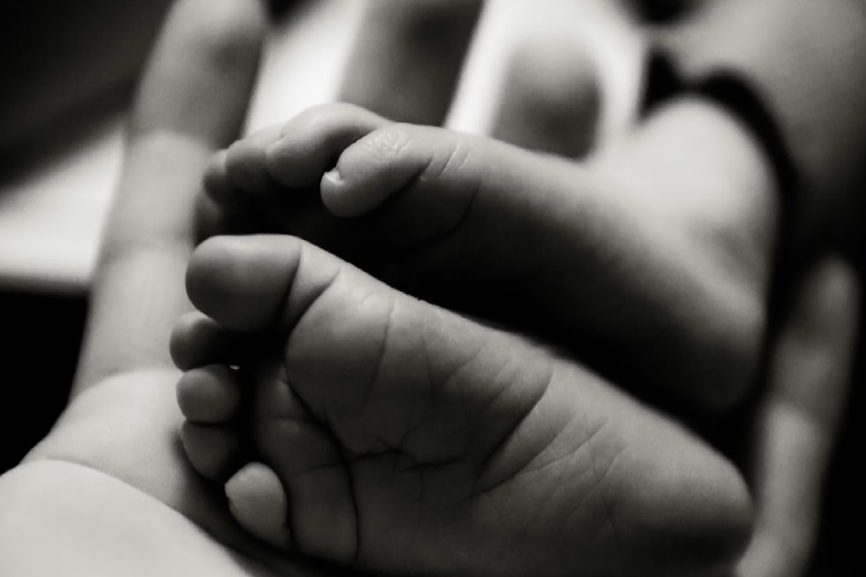 Limpopo conjoined twins, Mankweng Hospital NICU, newborn twins South Africa, Limpopo Health Department, neonatal intensive care, Joburg ETC