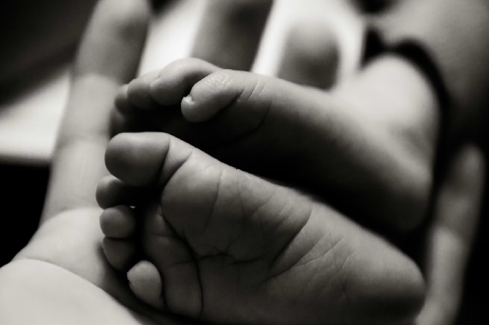 Limpopo conjoined twins birth, Mankweng Tertiary Hospital neonatal unit, conjoined twins South Africa, Limpopo Department of Health hospital care, neonatal intensive care Limpopo, medical team caring for conjoined twins, Joburg ETC