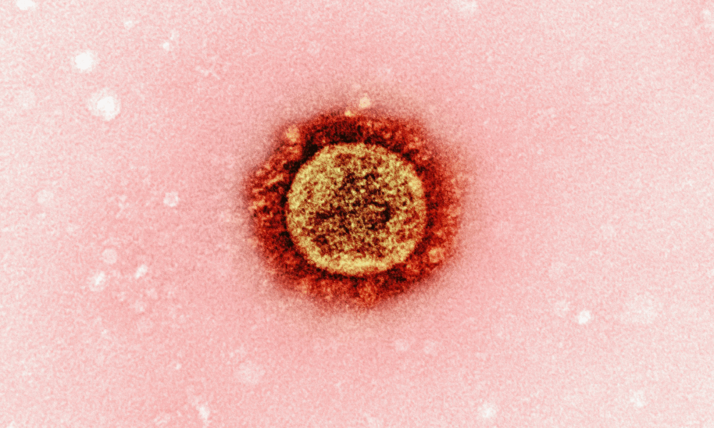 Picture: National Institute of Allergy and Infectious Diseases / Unsplash