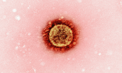 Picture: National Institute of Allergy and Infectious Diseases / Unsplash