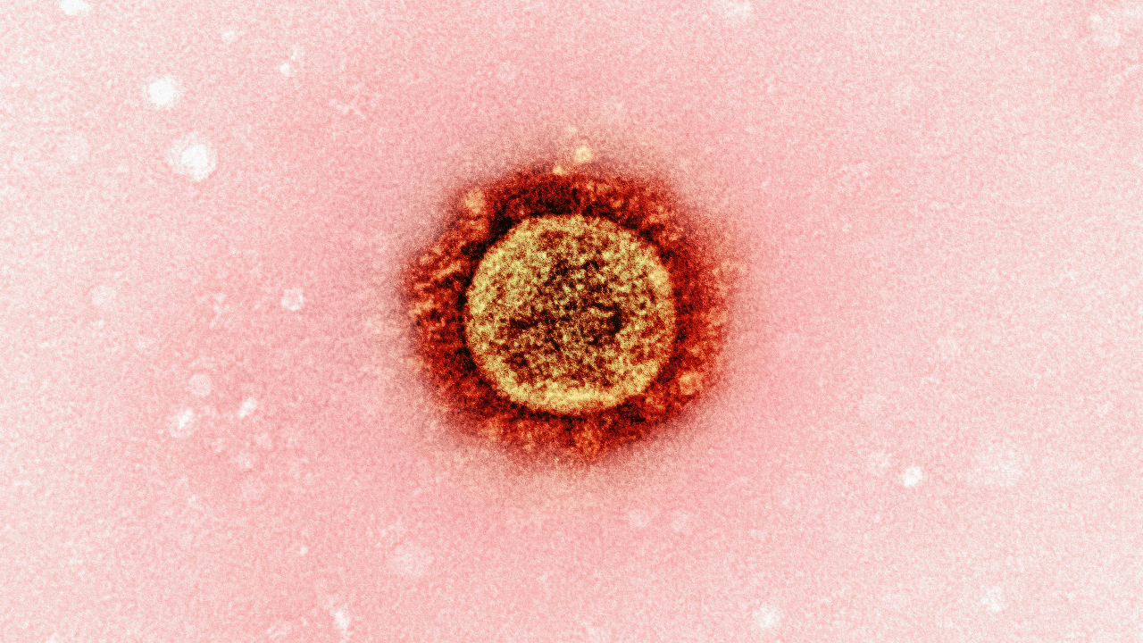 Picture: National Institute of Allergy and Infectious Diseases / Unsplash